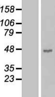 Western Blot: Carboxypeptidase B1/CPB1 Overexpression Lysate [NBL1-09429]