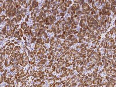 Immunohistochemistry-Paraffin: Carboxypeptidase B1/CPB1 Antibody (329) [NBP2-89533]