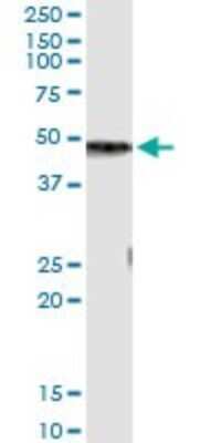 Immunoprecipitation: Carboxypeptidase B1/CPB1 Antibody (4D5) [H00001360-M01]