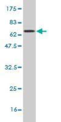 Western Blot: Carboxypeptidase B1/CPB1 Antibody (4D5) [H00001360-M01]