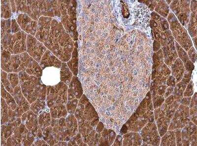 Immunohistochemistry-Paraffin: Carboxypeptidase B1/CPB1 Antibody [NBP2-15698]