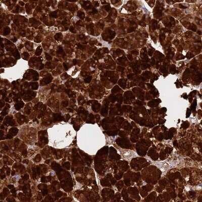 Immunohistochemistry-Paraffin: Carboxypeptidase B1/CPB1 Antibody [NBP2-38386]