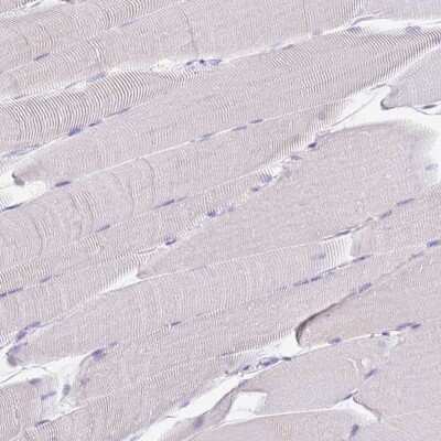 Immunohistochemistry-Paraffin: Carboxypeptidase B1/CPB1 Antibody [NBP2-38386]