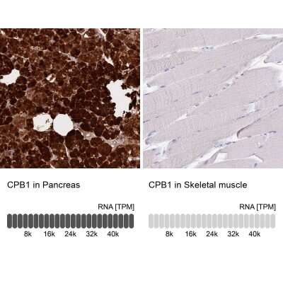 Immunohistochemistry-Paraffin: Carboxypeptidase B1/CPB1 Antibody [NBP2-38386]