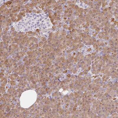 Immunohistochemistry-Paraffin: Carboxypeptidase B1/CPB1 Antibody [NBP2-38549]