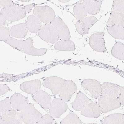 Immunohistochemistry-Paraffin: Carboxypeptidase B1/CPB1 Antibody [NBP2-38549]