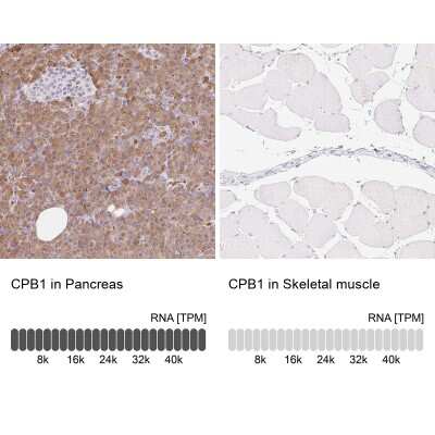Immunohistochemistry-Paraffin: Carboxypeptidase B1/CPB1 Antibody [NBP2-38549]