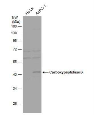 Western Blot: Carboxypeptidase B1/CPB1 Antibody [NBP1-32337]