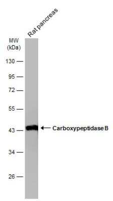 Western Blot: Carboxypeptidase B1/CPB1 Antibody [NBP1-32337]
