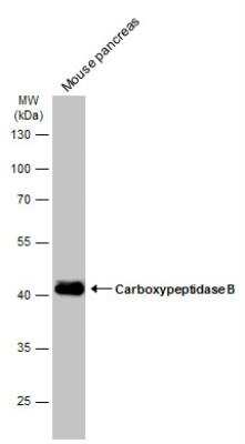 Western Blot: Carboxypeptidase B1/CPB1 Antibody [NBP1-32337]