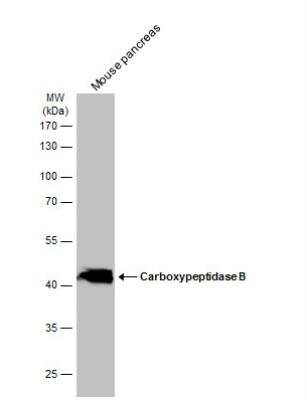 Western Blot: Carboxypeptidase B1/CPB1 Antibody [NBP2-15698]