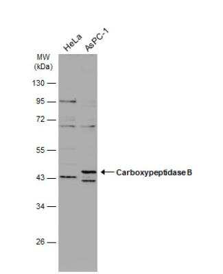 Western Blot: Carboxypeptidase B1/CPB1 Antibody [NBP2-15698]