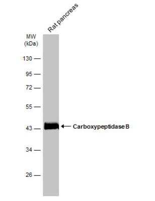 Western Blot: Carboxypeptidase B1/CPB1 Antibody [NBP2-15698]