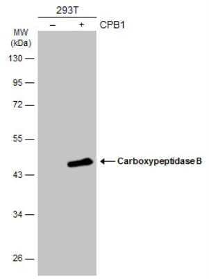 Western Blot: Carboxypeptidase B1/CPB1 Antibody [NBP2-15698]