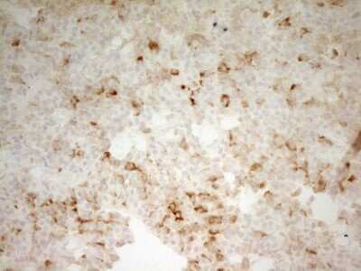 Immunohistochemistry: Carboxypeptidase B2/CPB2 Antibody (OTI3D5) [NBP2-46345]