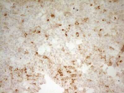 Immunohistochemistry: Carboxypeptidase B2/CPB2 Antibody (OTI3D5) - Azide and BSA Free [NBP2-70444]