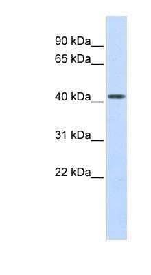 Western Blot: Carboxypeptidase B2/CPB2 Antibody [NBP1-57920]