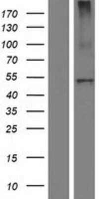 Western Blot: Carboxypeptidase B2/CPB2 Overexpression Lysate [NBP2-10776]