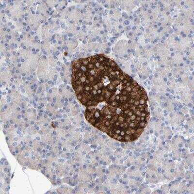 Immunohistochemistry-Paraffin: Carboxypeptidase E/CPE Antibody [NBP2-33853]