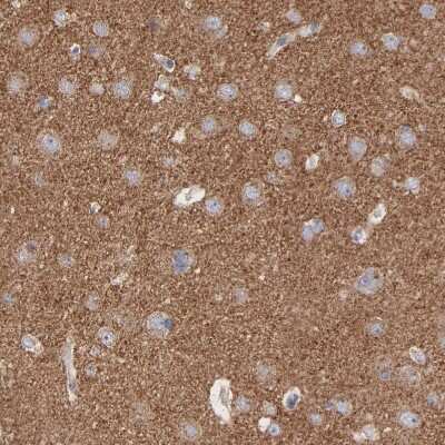 Immunohistochemistry-Paraffin: Carboxypeptidase E/CPE Antibody [NBP2-33853]