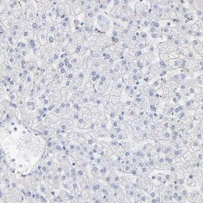 Immunohistochemistry-Paraffin: Carboxypeptidase E/CPE Antibody [NBP2-33853]