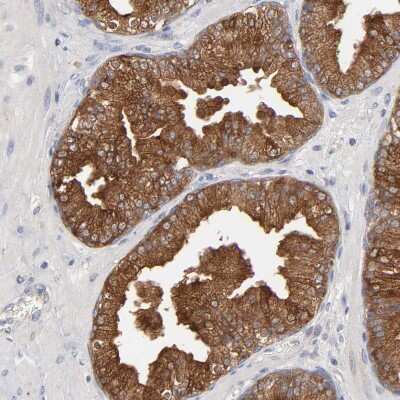 Immunohistochemistry-Paraffin: Carboxypeptidase E/CPE Antibody [NBP2-33853]