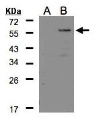 Western Blot: Carboxypeptidase E/CPE Antibody [NBP2-15699]