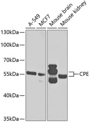 Western Blot: Carboxypeptidase E/CPE AntibodyBSA Free [NBP2-92655]