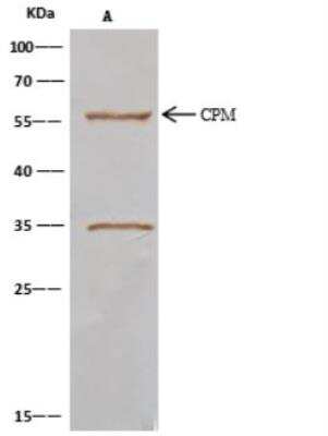 Immunoprecipitation: Carboxypeptidase M Antibody (105) [NBP2-89359]