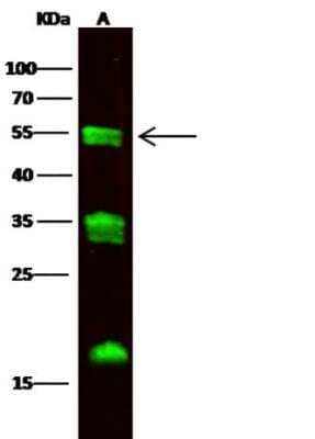 Western Blot: Carboxypeptidase M Antibody (105) [NBP2-89359]