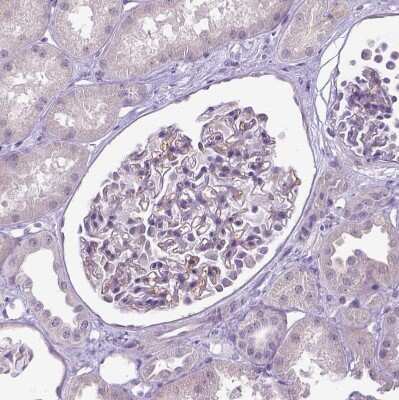 Immunohistochemistry-Paraffin: Carboxypeptidase M Antibody [NBP1-87403]