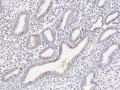 Immunohistochemistry-Paraffin: Carboxypeptidase M Antibody [NBP2-99755]