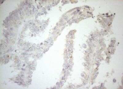 Immunohistochemistry: Carboxypeptidase M Antibody (OTI2D11) - Azide and BSA Free [NBP2-70446]