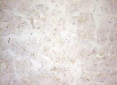 Immunohistochemistry: Carboxypeptidase M Antibody (OTI2D11) - Azide and BSA Free [NBP2-70446]