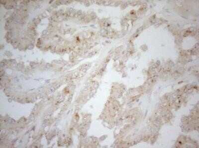 Immunohistochemistry: Carboxypeptidase M Antibody (OTI2D11) - Azide and BSA Free [NBP2-70446]