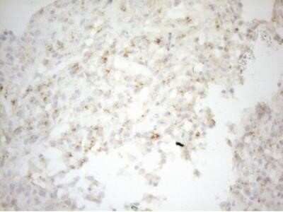 Immunohistochemistry: Carboxypeptidase M Antibody (OTI2D11) - Azide and BSA Free [NBP2-70446]