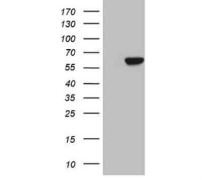 Western Blot: Carboxypeptidase M Antibody (OTI2D11)Azide and BSA Free [NBP2-70446]