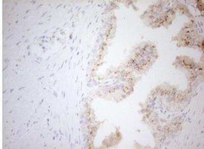 Immunohistochemistry-Paraffin: Carboxypeptidase M Antibody (OTI2D11) [NBP2-46352]