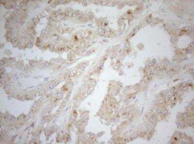 Immunohistochemistry-Paraffin: Carboxypeptidase M Antibody (OTI2D11) [NBP2-46352]