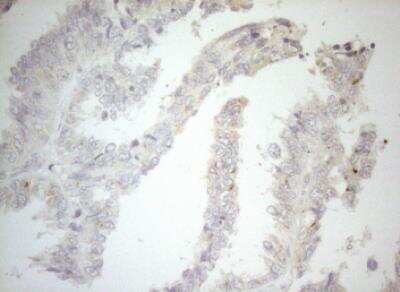 Immunohistochemistry-Paraffin: Carboxypeptidase M Antibody (OTI2D11) [NBP2-46352]