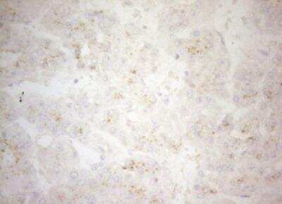 Immunohistochemistry-Paraffin: Carboxypeptidase M Antibody (OTI2D11) [NBP2-46352]