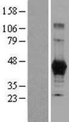 Western Blot: Carboxypeptidase M Overexpression Lysate [NBL1-09438]