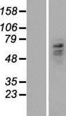 Western Blot: Carboxypeptidase M Overexpression Lysate [NBP2-04724]