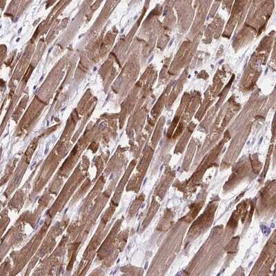 Immunohistochemistry-Paraffin: Cardiac Leiomodin Antibody [NBP2-30648]