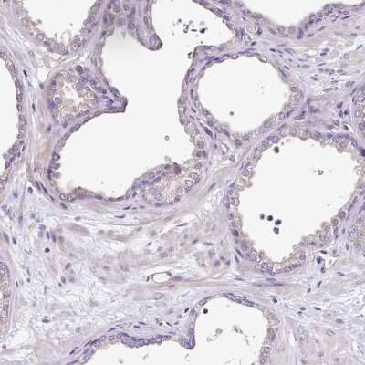 Immunohistochemistry-Paraffin: Cardiac Leiomodin Antibody [NBP2-30648]