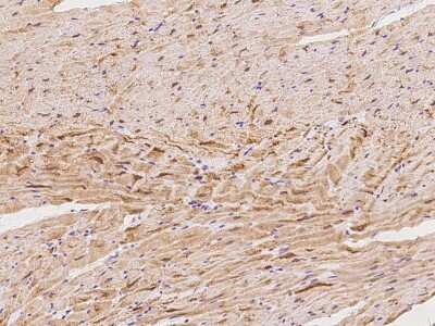 Immunohistochemistry-Paraffin: Cardiac Leiomodin Antibody [NBP2-97438]
