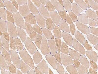 Immunohistochemistry-Paraffin: Cardiac Leiomodin Antibody [NBP2-97438]