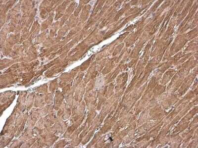 Immunohistochemistry-Paraffin: Cardiac Troponin T Antibody [NBP3-13391]
