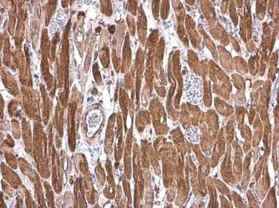 Immunohistochemistry-Paraffin: Cardiac Troponin T Antibody [NBP3-13391]