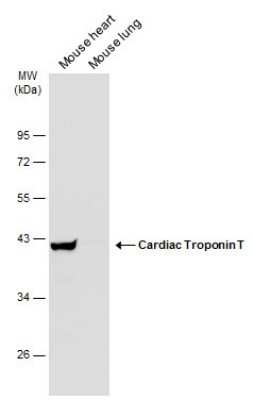 Western Blot: Cardiac Troponin T Antibody [NBP3-13030]